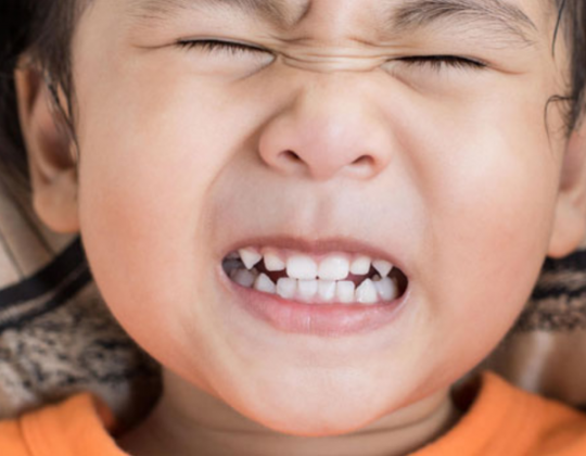Cảnh báo nguy cơ thiếu chất ở trẻ ngủ nghiến răng mà cha mẹ không nên bỏ qua