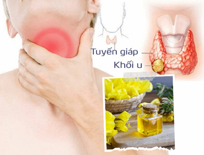 Tác dụng phụ của tinh dầu hoa anh thảo